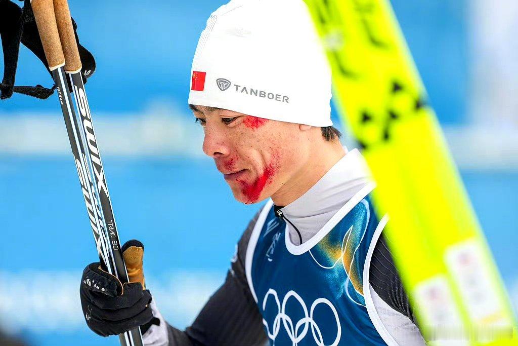 全场观众向赵子贺致意赵子贺摔倒带伤坚持完赛，满脸血迹依然冲向终点。全场起立致意，