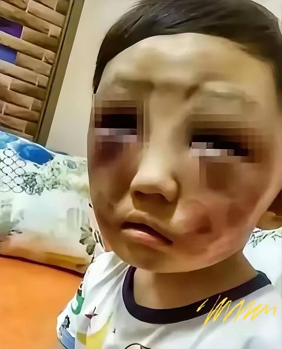 六岁男孩满身伤痕找妈妈，继父一句话看哭无数人
 
父母离婚后，六岁小男孩跟着父亲