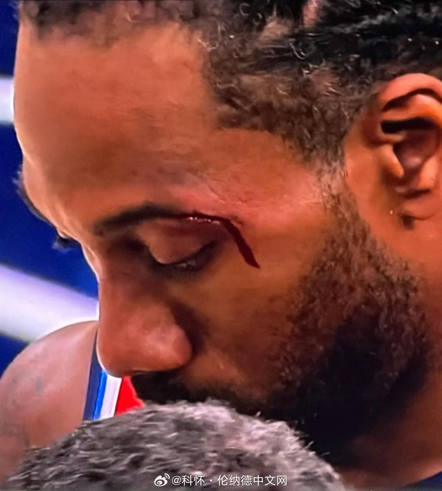 伦纳德本场不会回归了，离场前已经拿到31分…祈祷没有大碍啊又是眉骨又是脚踝，今天