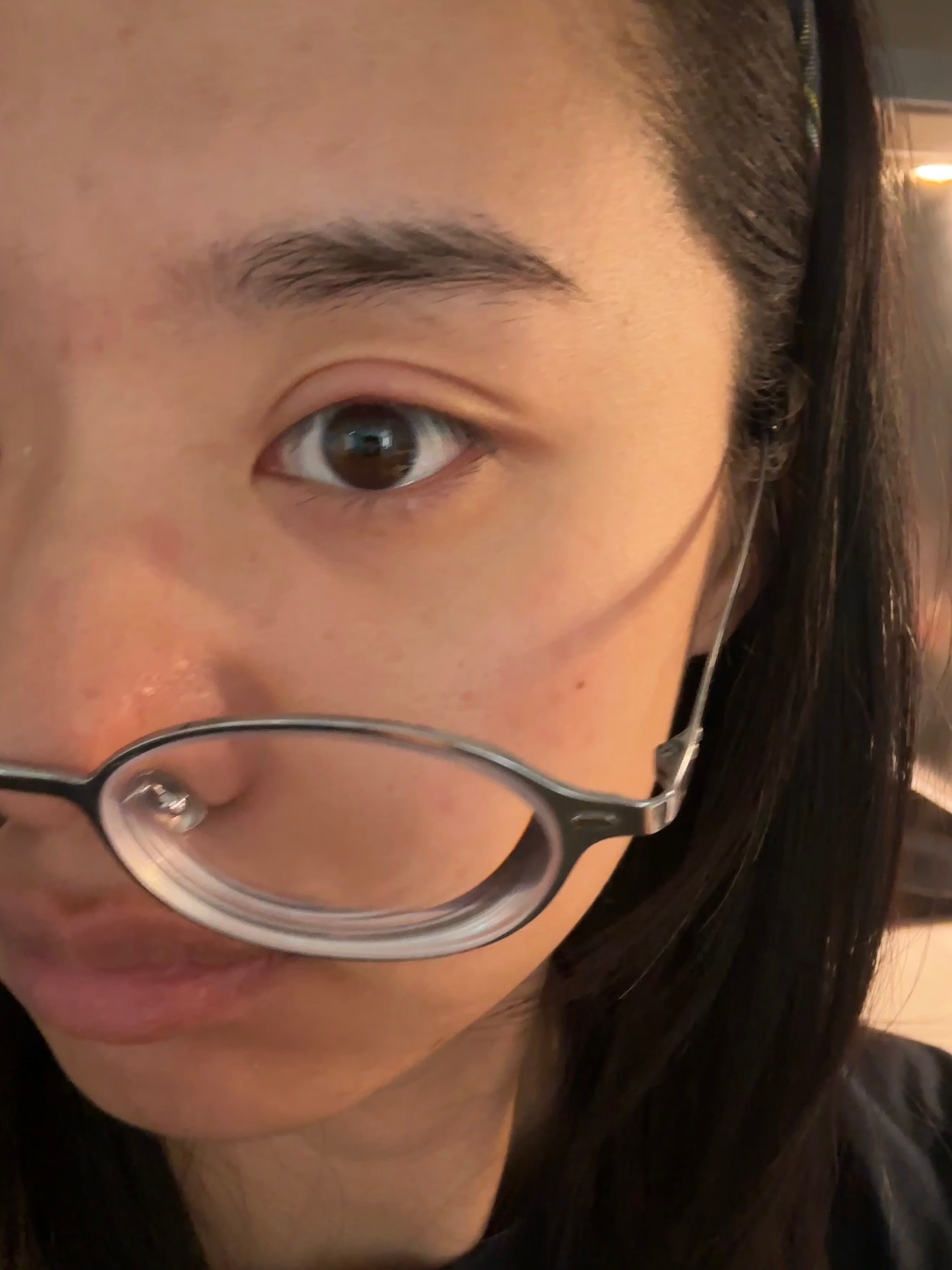 一觉醒来麦粒肿更大了喜提欧式大双 