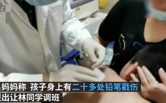 “有些孩子就是一肚子坏水！”广东一女子给儿子洗澡时，发现儿子背上有20个“血窟窿