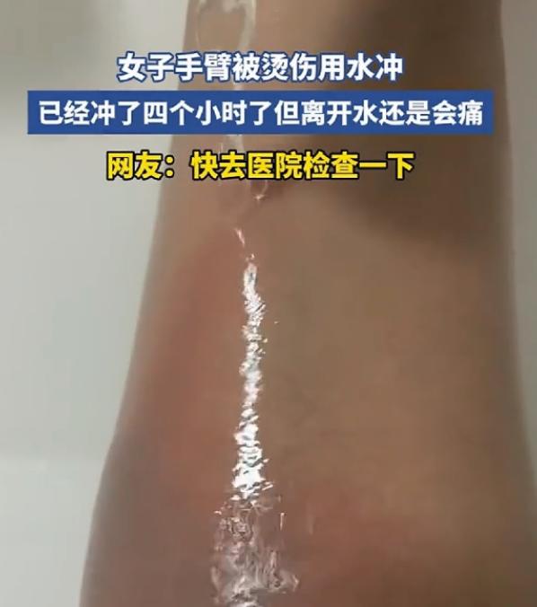 山东，一女子手臂不慎被烫伤，于是女子赶紧用流动水冲烫伤部位，结果没想到女子这么一
