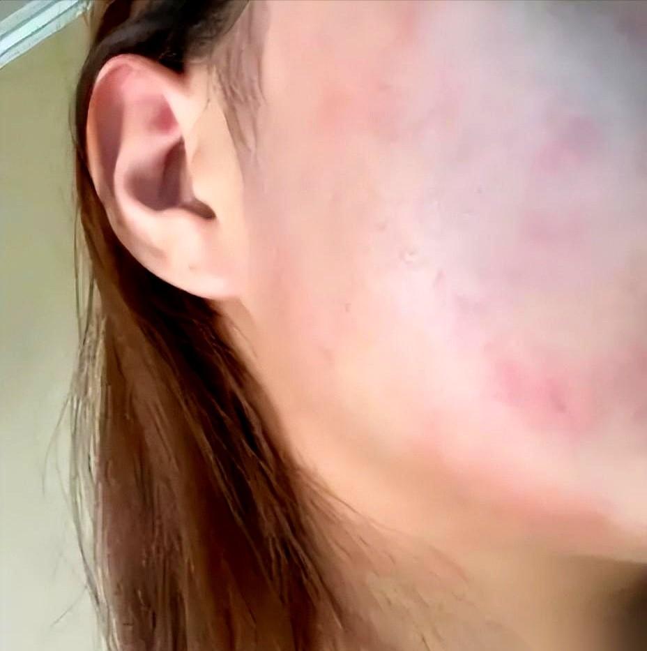 情侣间互相亲吻私处，很多人觉得，这是关系到位的证明。
但在医生眼里，这更像一场两