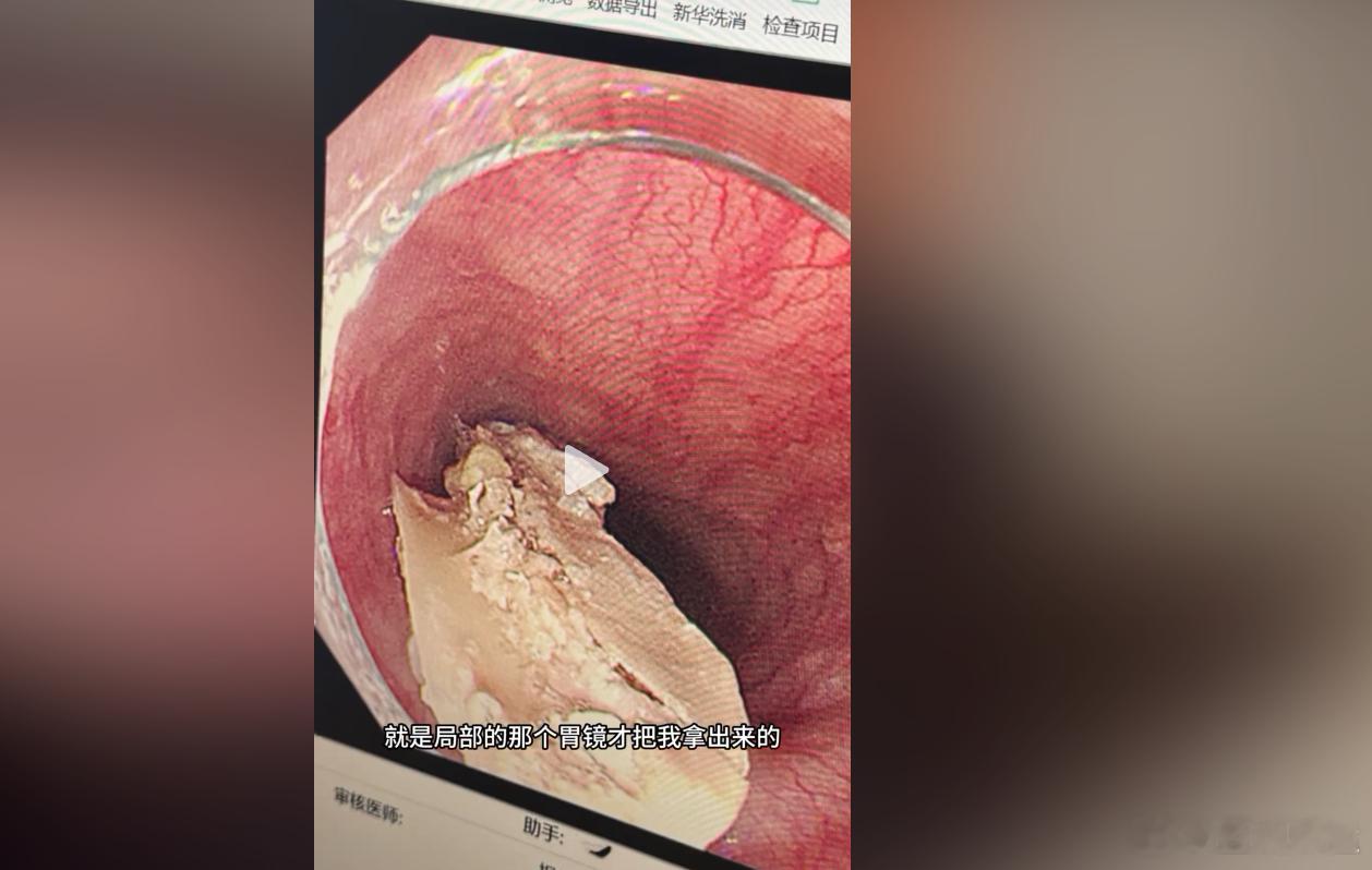 中国游泳前美女国手差点意外离世 大难不死讲述惊魂一刻 告诫网友九个字！曾经创造女