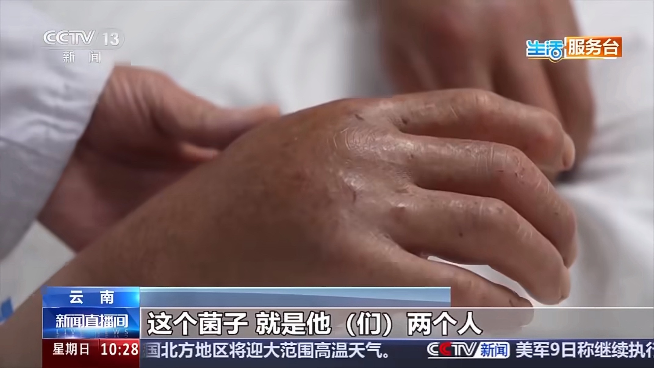 2人采菌子吃完肿得像面包太吓人了！这菌子自带“发面”功能？吃完真就“见不得光”了