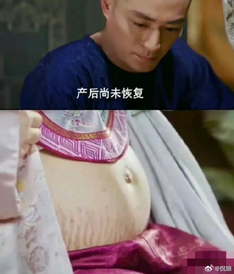 我认为《如懿传》最扯的剧情就是这里，海兰因为妊娠纹而失宠，这不是纯纯制造女性焦虑