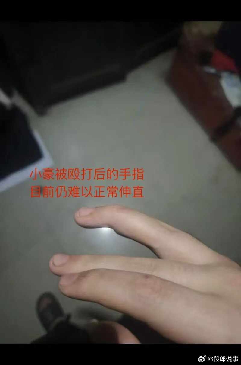 20岁男子被送戒网瘾反手起诉机构及父亲重庆一戒网瘾机构仍有近百名成年人被困 都2