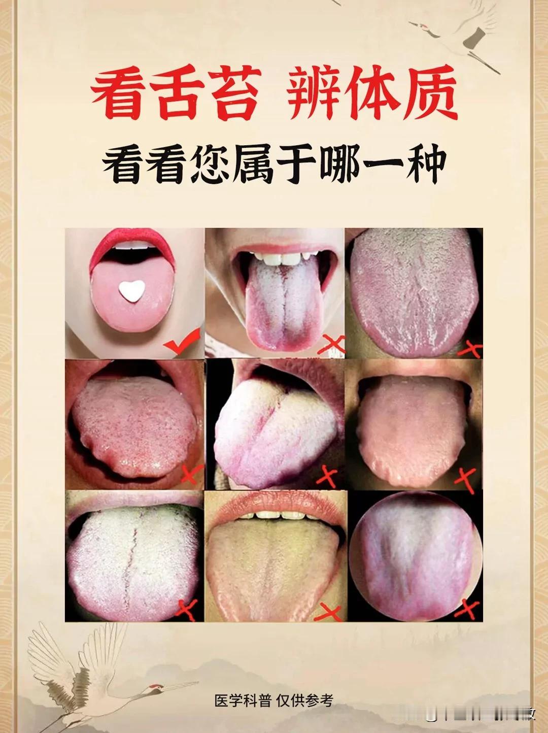简单伸伸舌头，就能分辨身体情况
张医生手把手教你看舌头，只要1分钟，立马学会
#