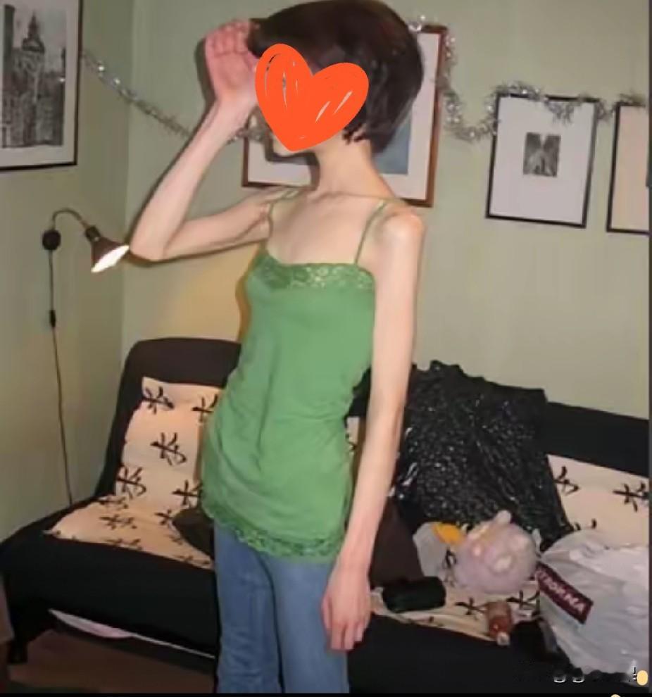 河南这位31岁女生，本身只是微胖，却选择半个月几乎不吃东西，只靠喝水硬扛，一个月