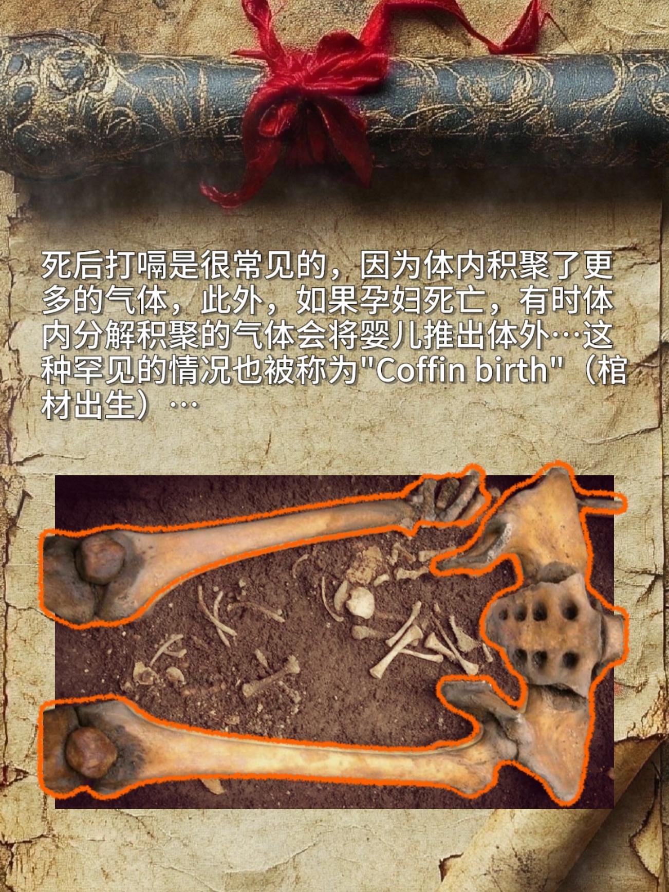 死后打嗝是很常见的，因为体内积聚了更多的气体，此外，如果孕妇死亡，有时...