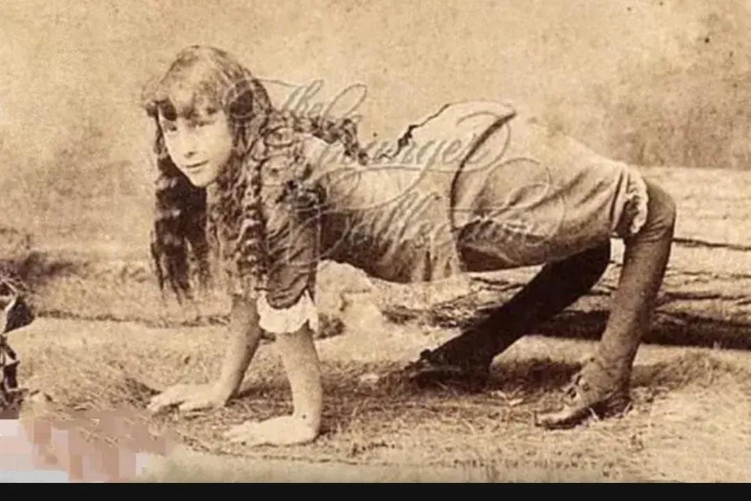 1890年的美国，一位与众不同的女孩，她名叫埃拉哈珀，被称作“骆驼女孩”，因为她