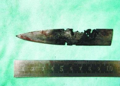 2011年，云南省某人民医院，一男子说自己一天刷十次牙，但一张嘴就是伴着铁锈的恶