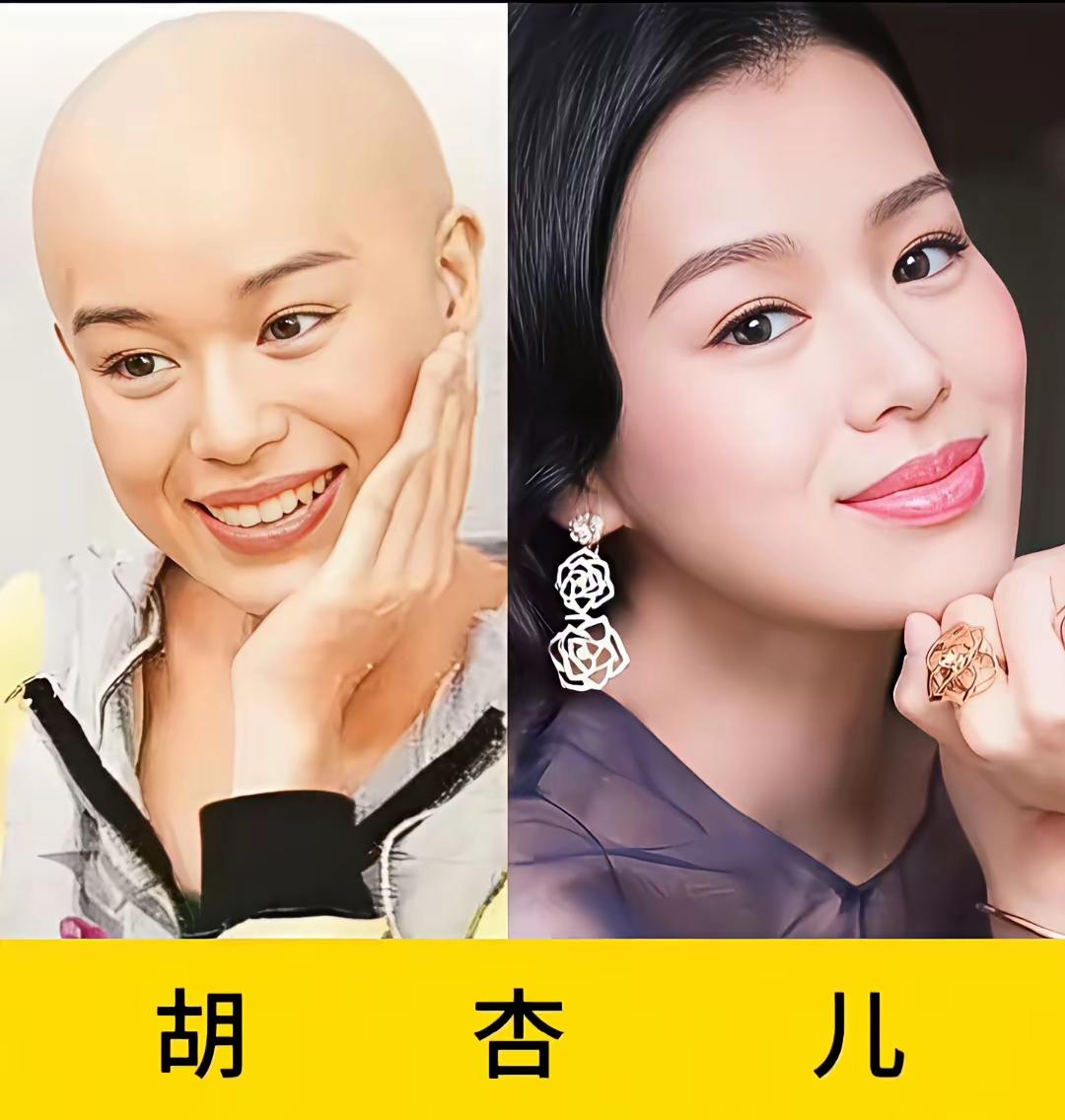 光头造型的胡杏儿
光头造型的周冬雨
光头造型的颖儿
论头发对颜值的重要性，这三位