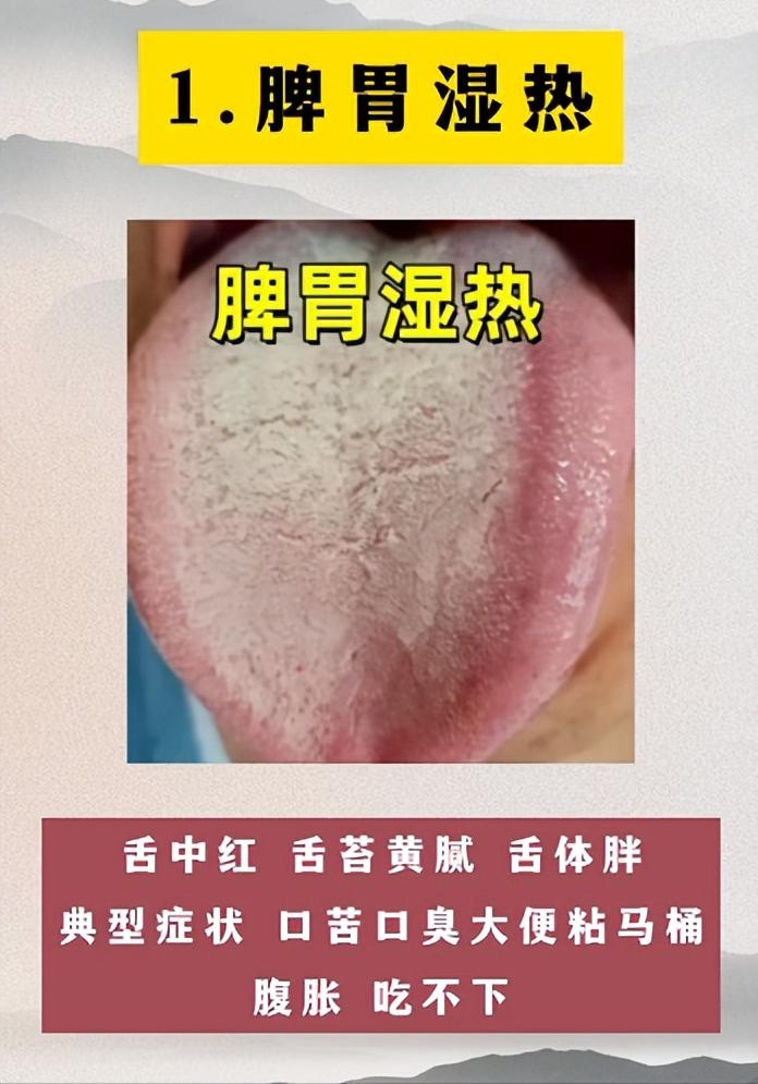 不同的湿热的表现~