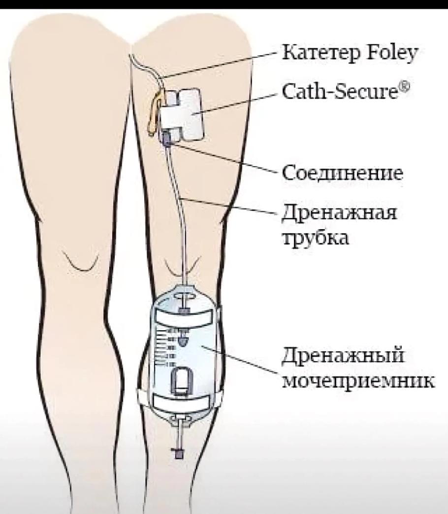 特朗普腿上藏“神秘物件”？这瓜刚冒头就变味了！
 
最近传得有鼻子有眼，说美媒拍