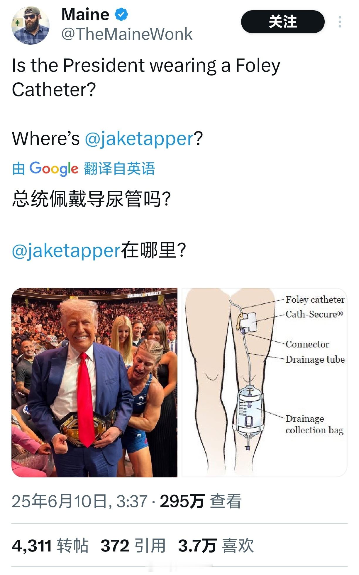 特朗普的腿这几天，特朗普的腿成为许多网民的谈资。 ​​​