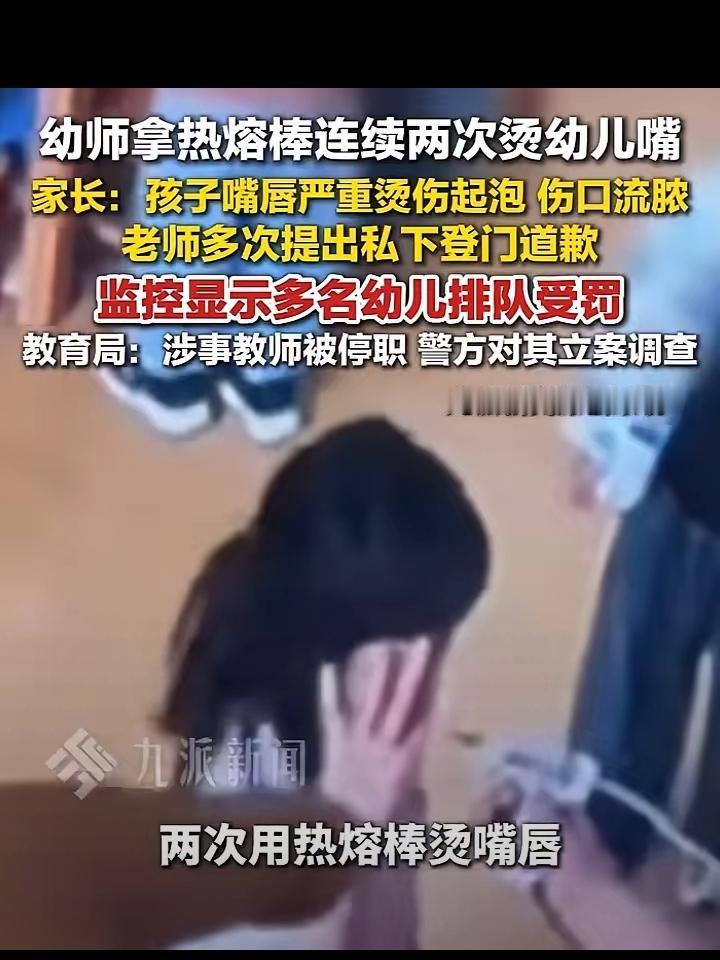 幼师用热熔棒烫伤幼儿嘴唇，恶劣行径绝不姑息！
 
涉事教师已被停职，教育局发布消