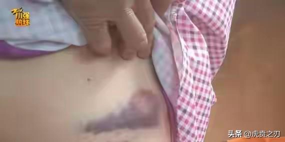 女子上班路上被大狼狗扑咬得血肉模糊！狗主人：赔3万？不可能！警方已介入

提点：
