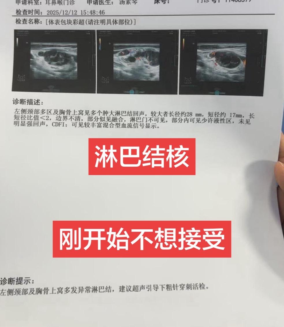 到现在坦然接受，慢慢适应吃药，好像也不是什么大事，那加油吧淋巴结核