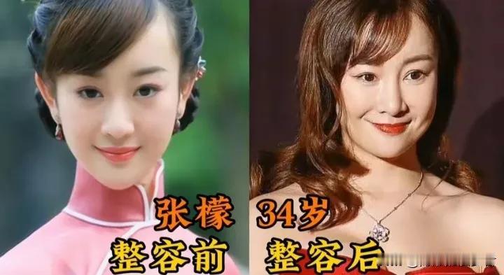 10位整容翻车女星，天然颜值才经得住时光。
不少女明星年轻时五官精致，自带灵动气