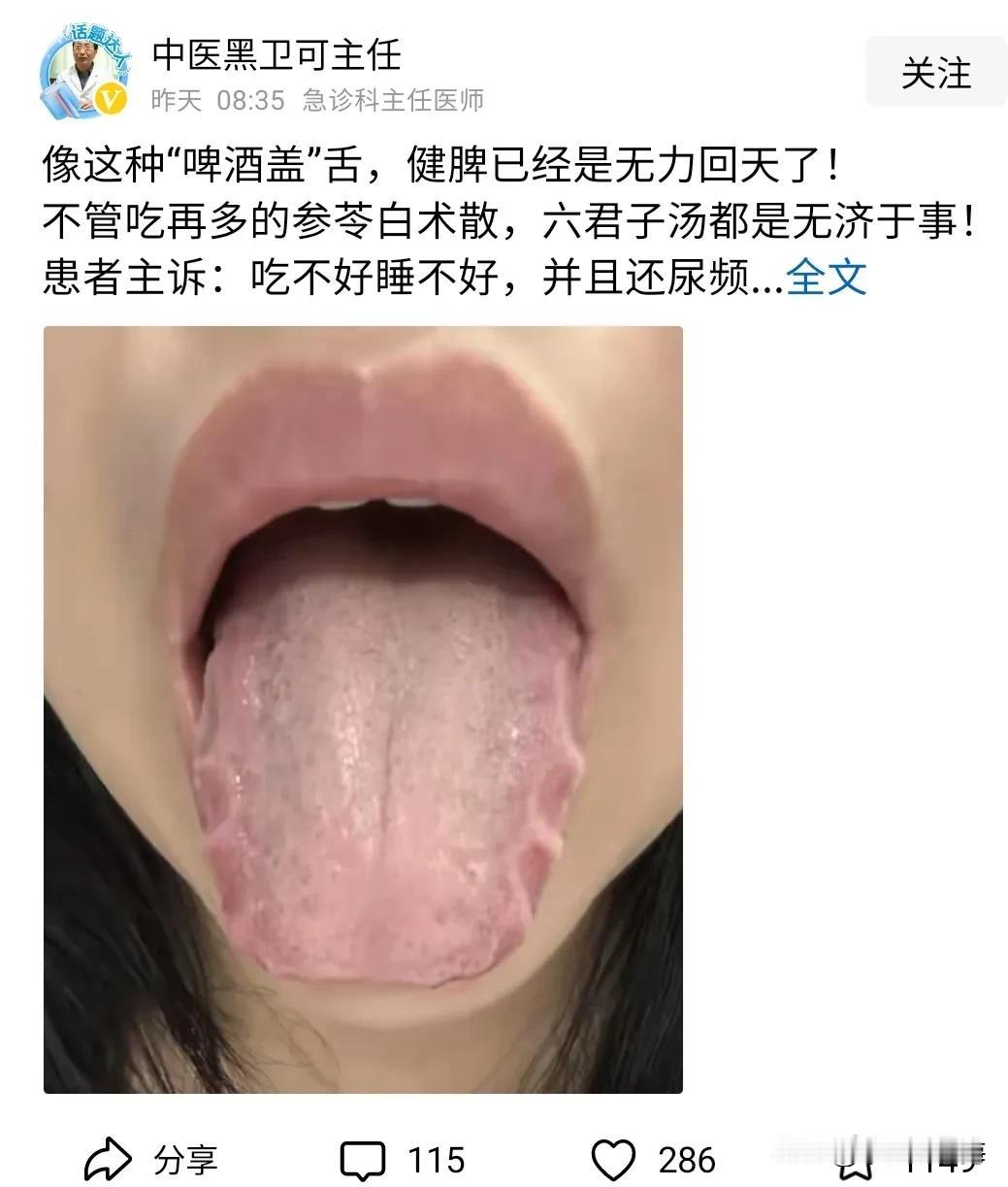 啤酒盖舌，挺形象。
望而知之为之神。