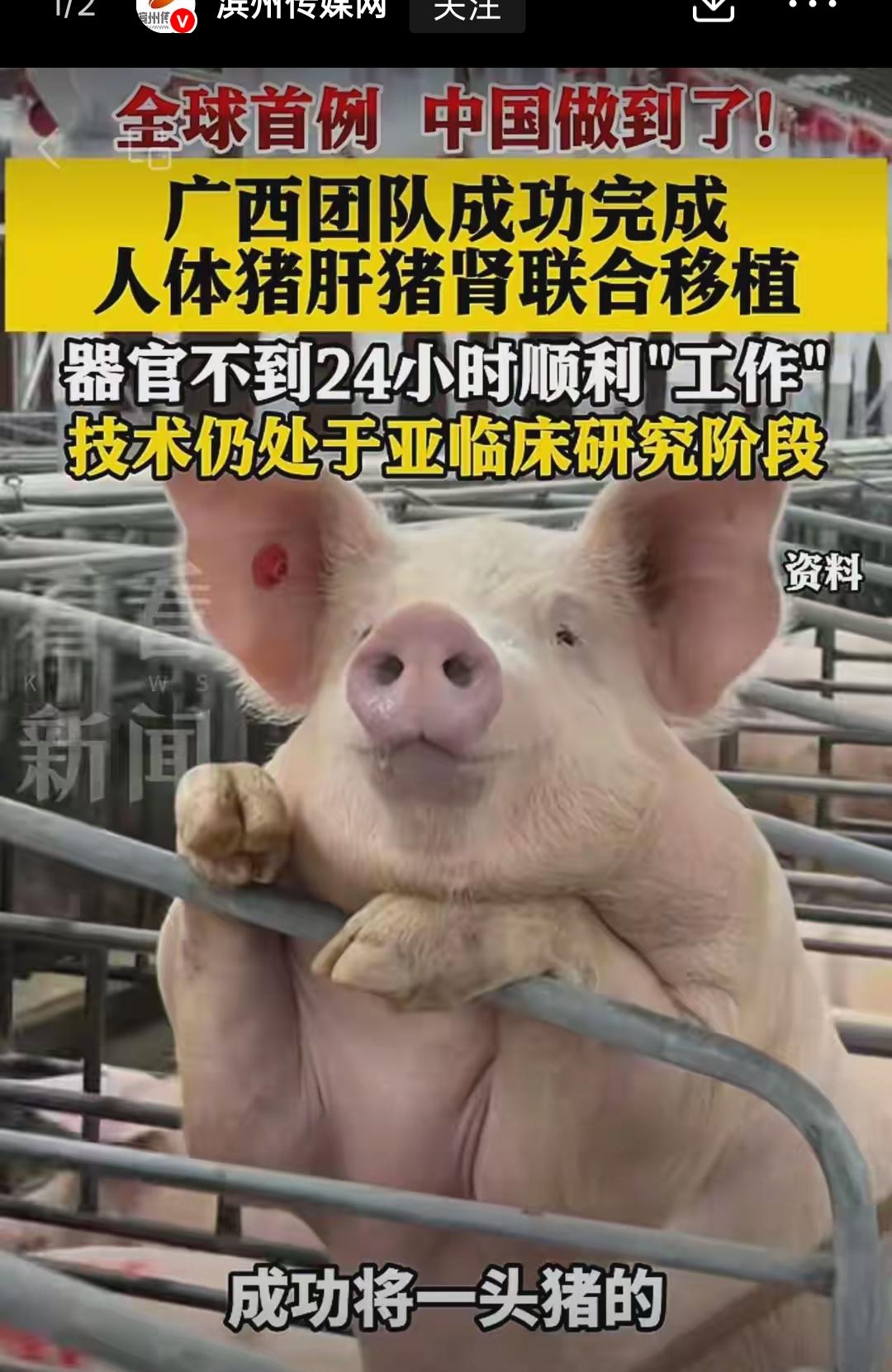 谁能想到困扰医学界多年的器官紧缺难题，正在被咱们国内科研团队撕开突破口。广西医疗
