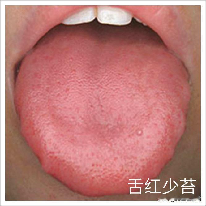 肝虚高血压，脾虚高血脂，肾虚高血糖，中医教你调
肝虚高血压
原理：肝血不足，不能