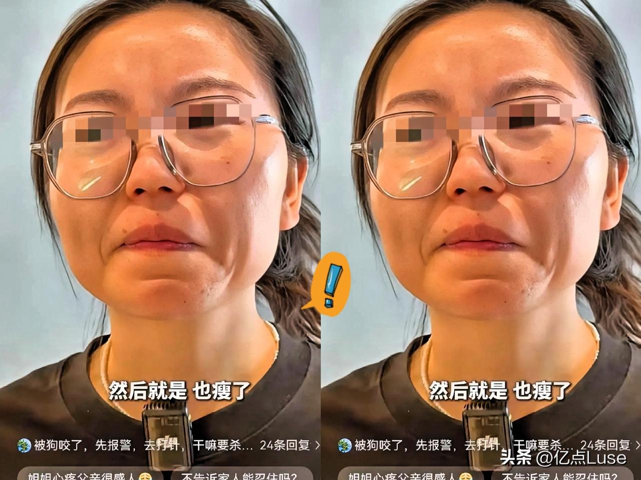 山西狗咬人事件儿后续反转了…
被狗咬的申某的姐姐，和狗主人的妻子，现在都后悔了。