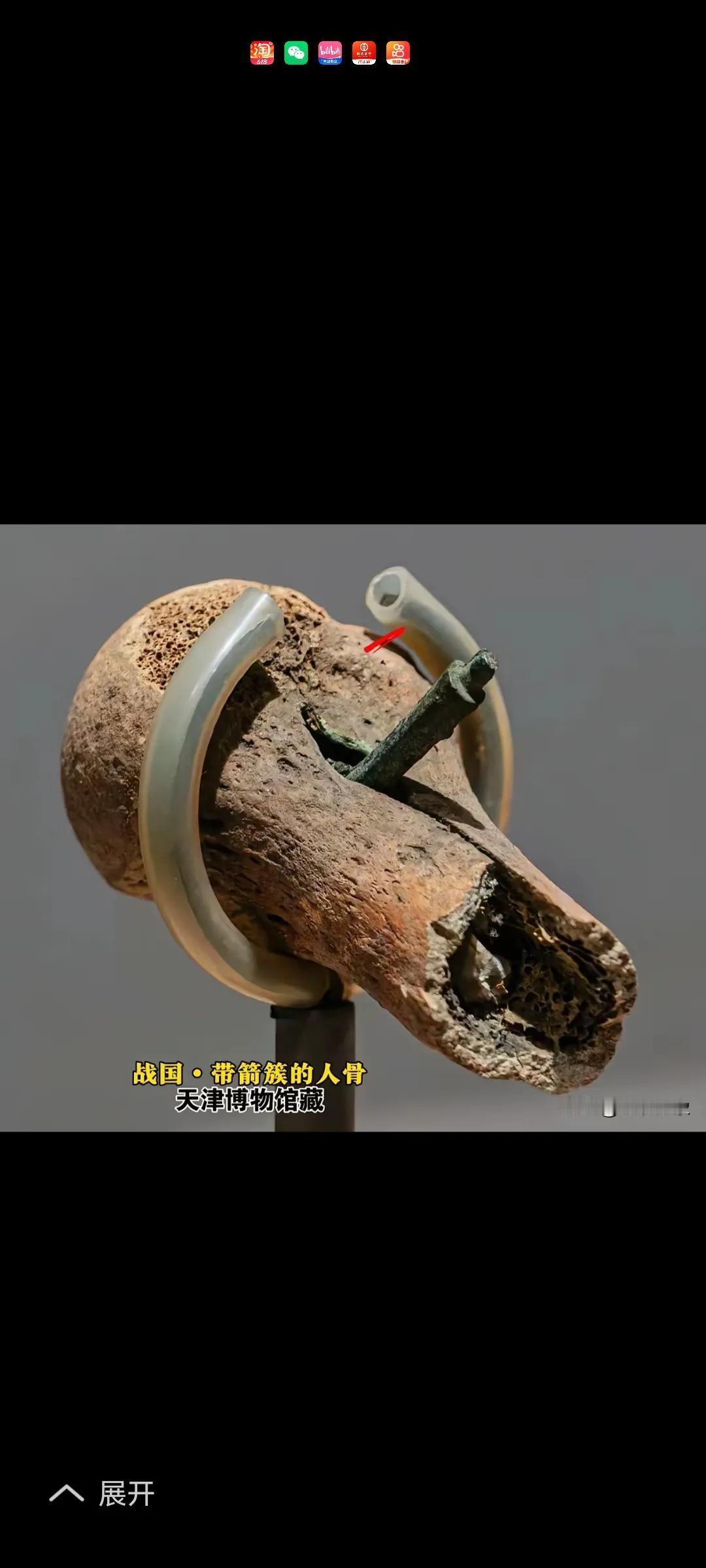 2400年前士兵战斗中腿部中箭，至今仍插在骨头里，深度6公分，战国时期。天津博物