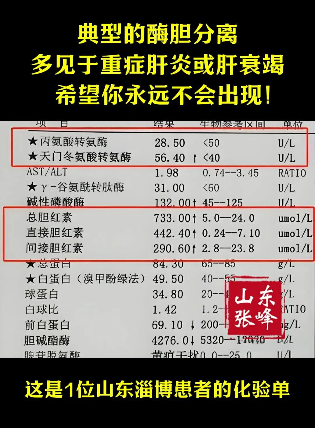 希望你永远不要出现！转氨酶不怎么高，但胆红素异常升高，这个时候可别觉得...