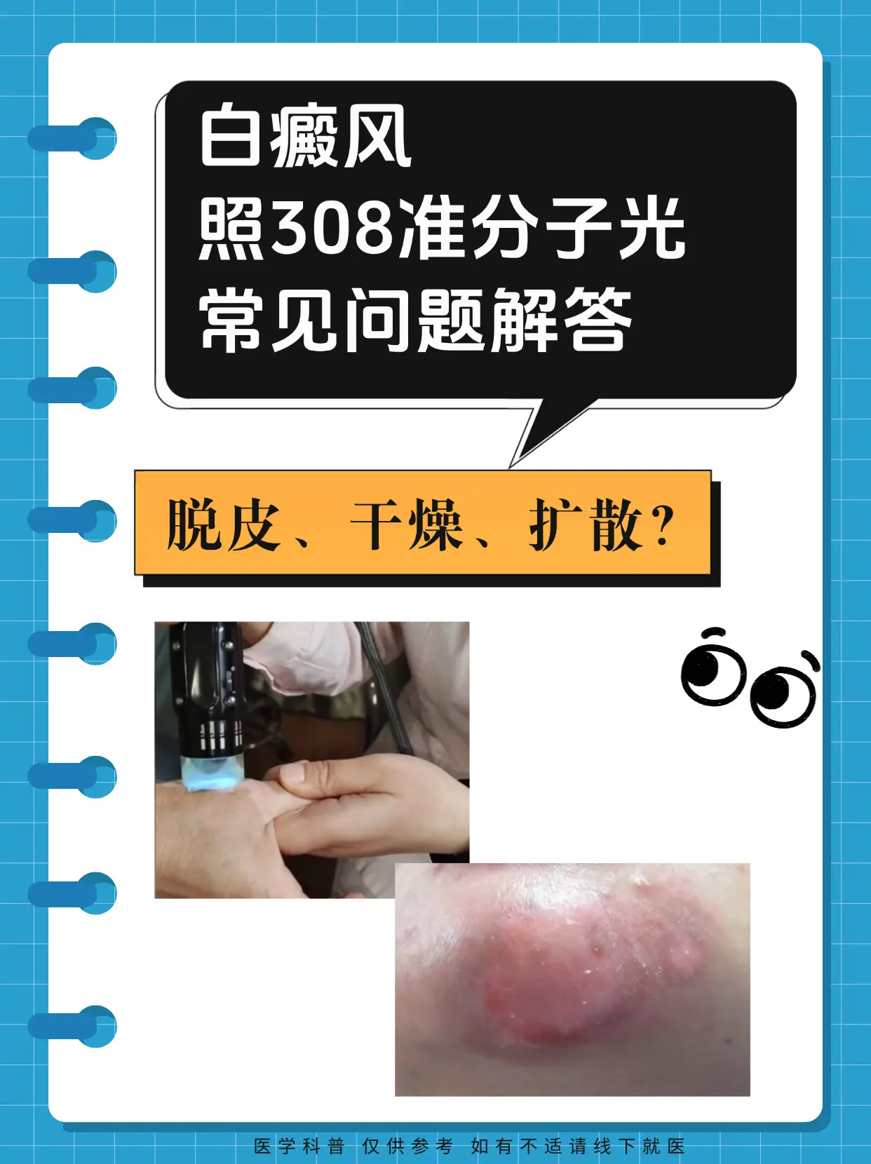 医学科普 白癜风 白癜风科普 抖出健康知识宝藏  白癜风好了