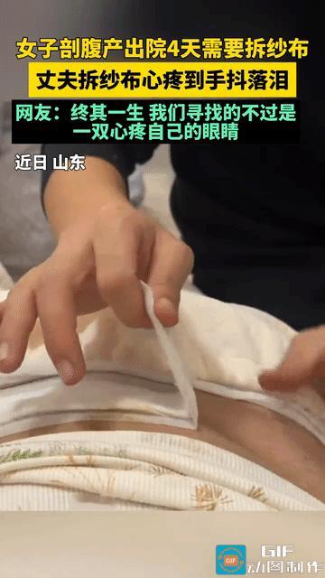 山东，女子剖腹产第4天需要拆纱布，女子自己不方便拆就让老公帮忙。当老公看到女子肚