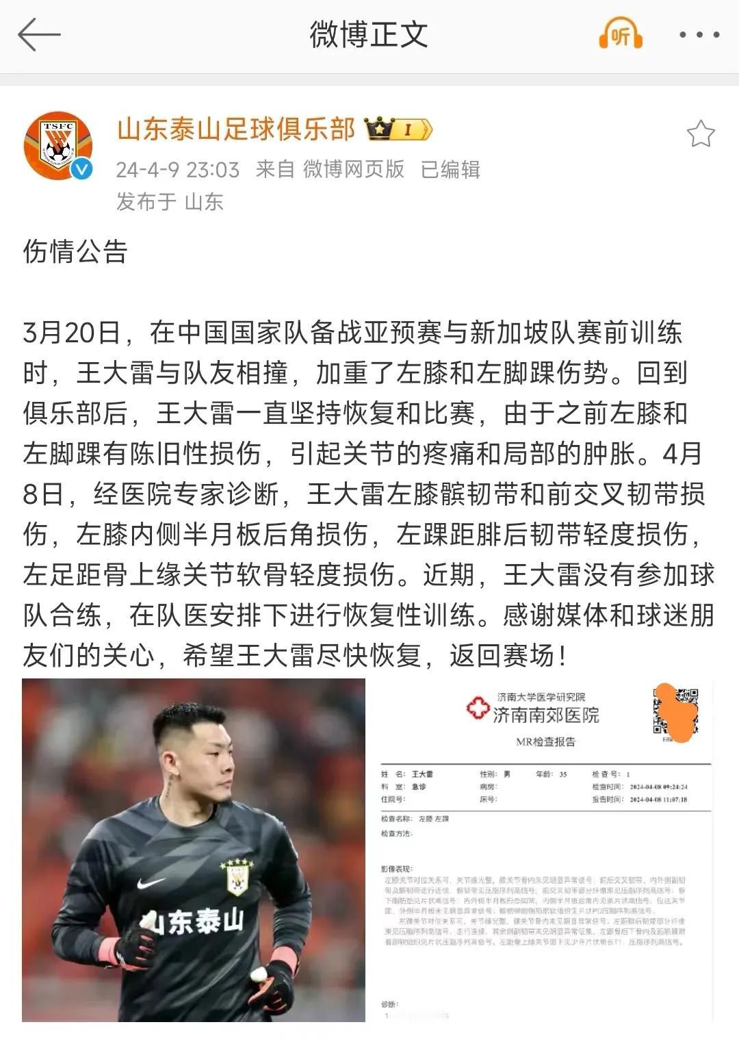 山东泰山队今天官宣王大雷伤情公告，吴兴涵眼角缝了18针，大股东文旅没钱投入，也可