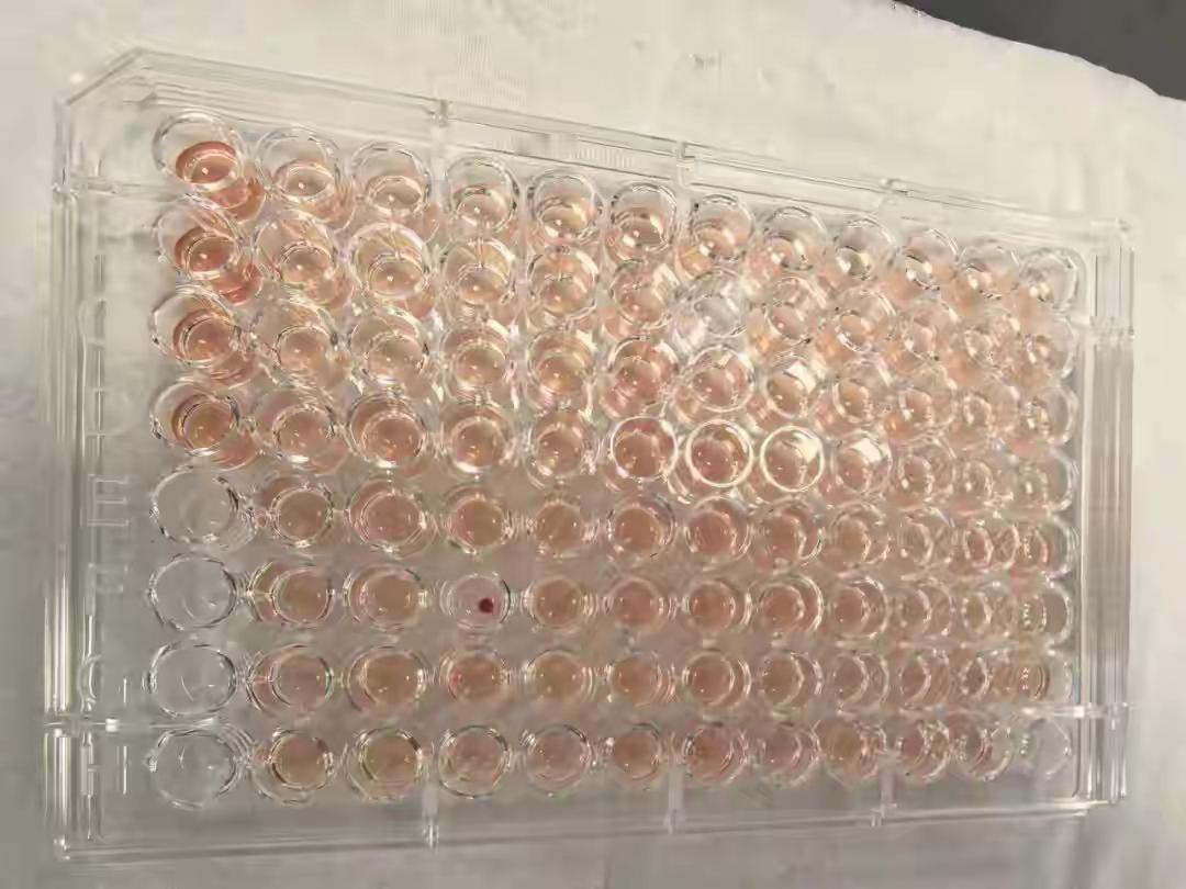 首例！广东顺德发现一例“钻石血”，比“熊猫血”罕见百倍
 
刷到这条新闻时直接惊