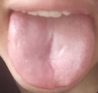 降低敏感，不止是临时缓解，中医教你根源调理







很多上了年纪的朋友总是