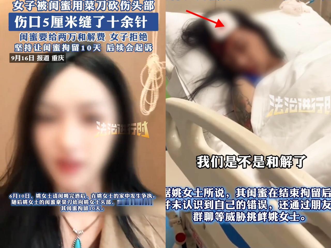 谁能想到，
掏心窝子请闺蜜喝酒，
换来的竟是菜刀
劈头盖脸砍过来？重庆姚女士的经