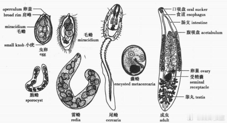 5人聚餐后全部确诊肝吸虫病肝吸虫病是华支睾吸虫寄生在人体肝脏胆管里的寄生虫病 。