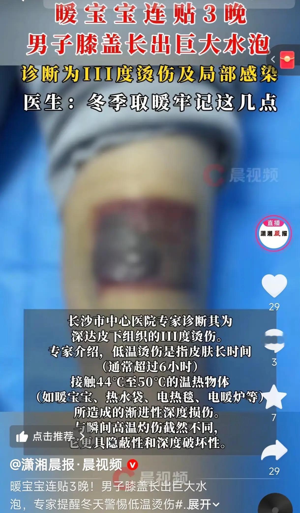 “悲剧还是发生了！”湖南长沙，一男子膝盖疼，为了缓解，直接在膝盖处贴了暖宝宝，贴