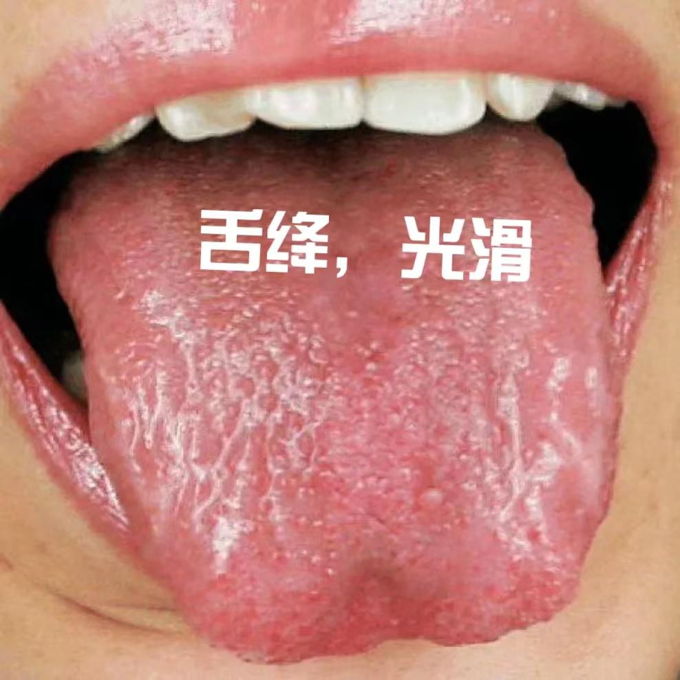 舌头上没有舌苔是什么病？中医告诉你
之前讲过了舌头上有裂纹代表的含义，那舌头上没