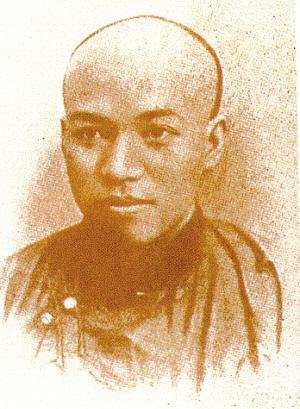 1926年，梁启超尿血，西医诊断必须切除右肾存在的肿瘤。然而，手术后医生傻眼了，