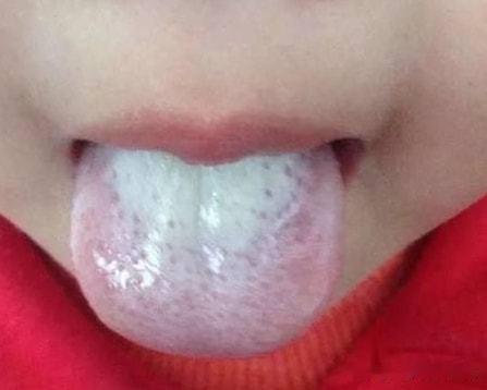 昨天一个孩子过来复诊，这小孩儿我给他调理了3个月就长高了3.2cm！

第一次给