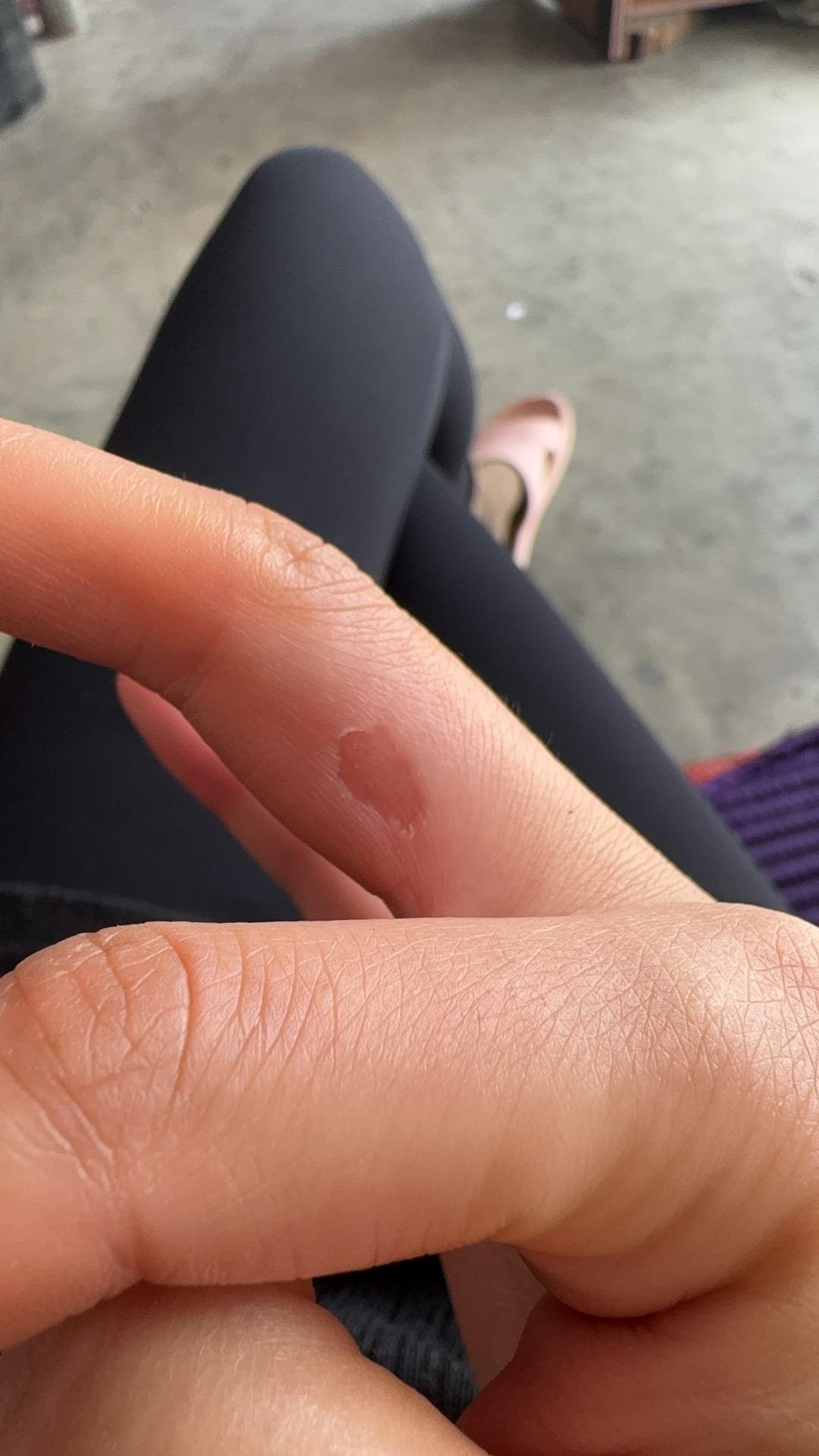 挖菜累了一天收获一个大泡