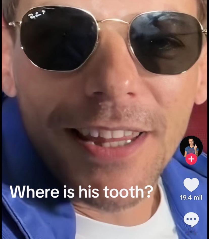 最近，有网友发现，英国男团 One Direction 成员 Louis 的近照
