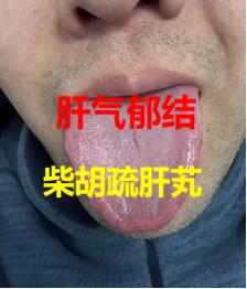 6 种男科问题，6 个中成药一网打尽！看看你是哪种？建议收藏

① 越急越难起 