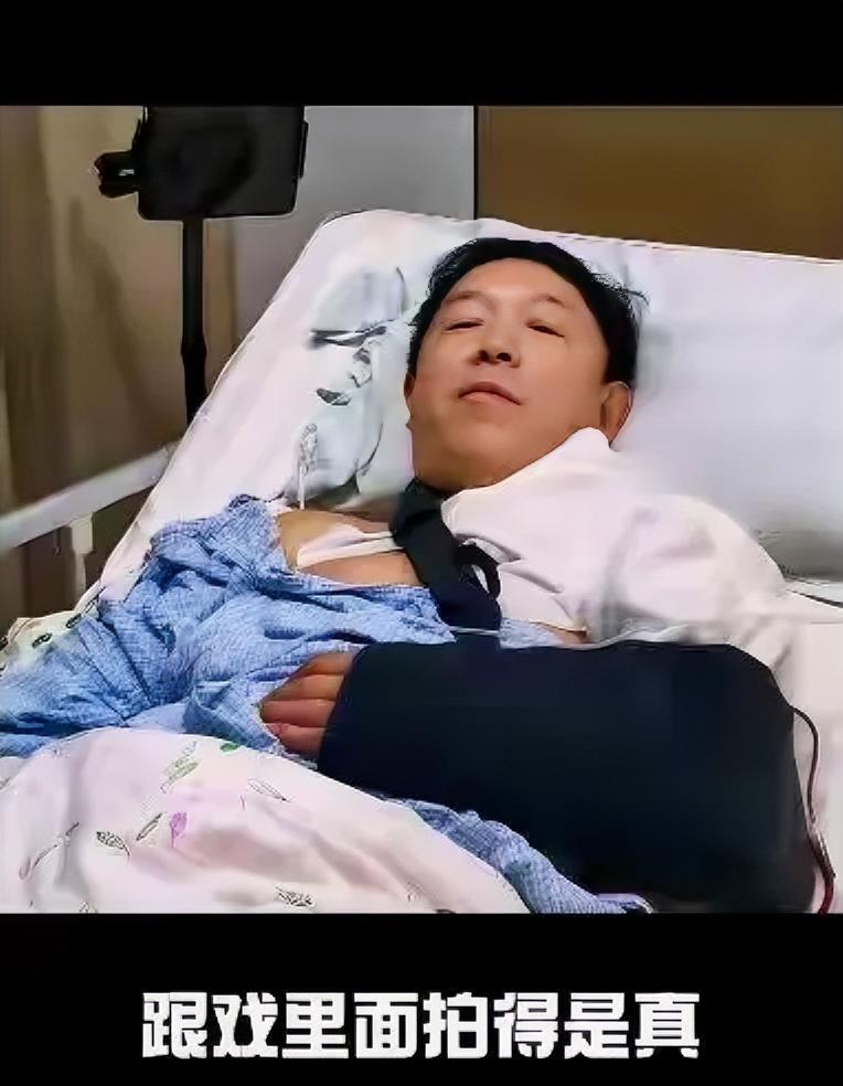52岁青岛明星黄渤因期骑车“走神儿”导致锁骨摔裂住院，令人唏嘘！也说明了一个问题