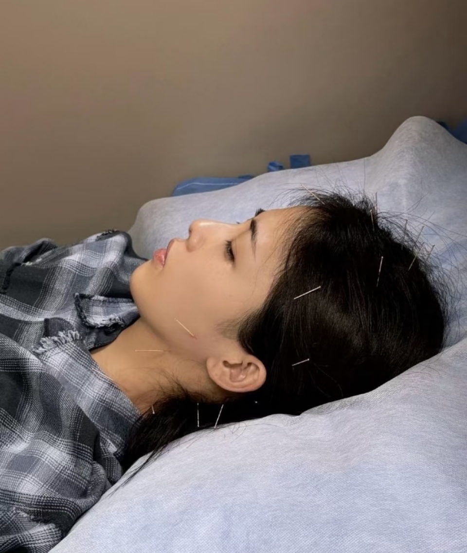 白鹿针灸图白鹿针灸了白鹿去针灸了！！白鹿