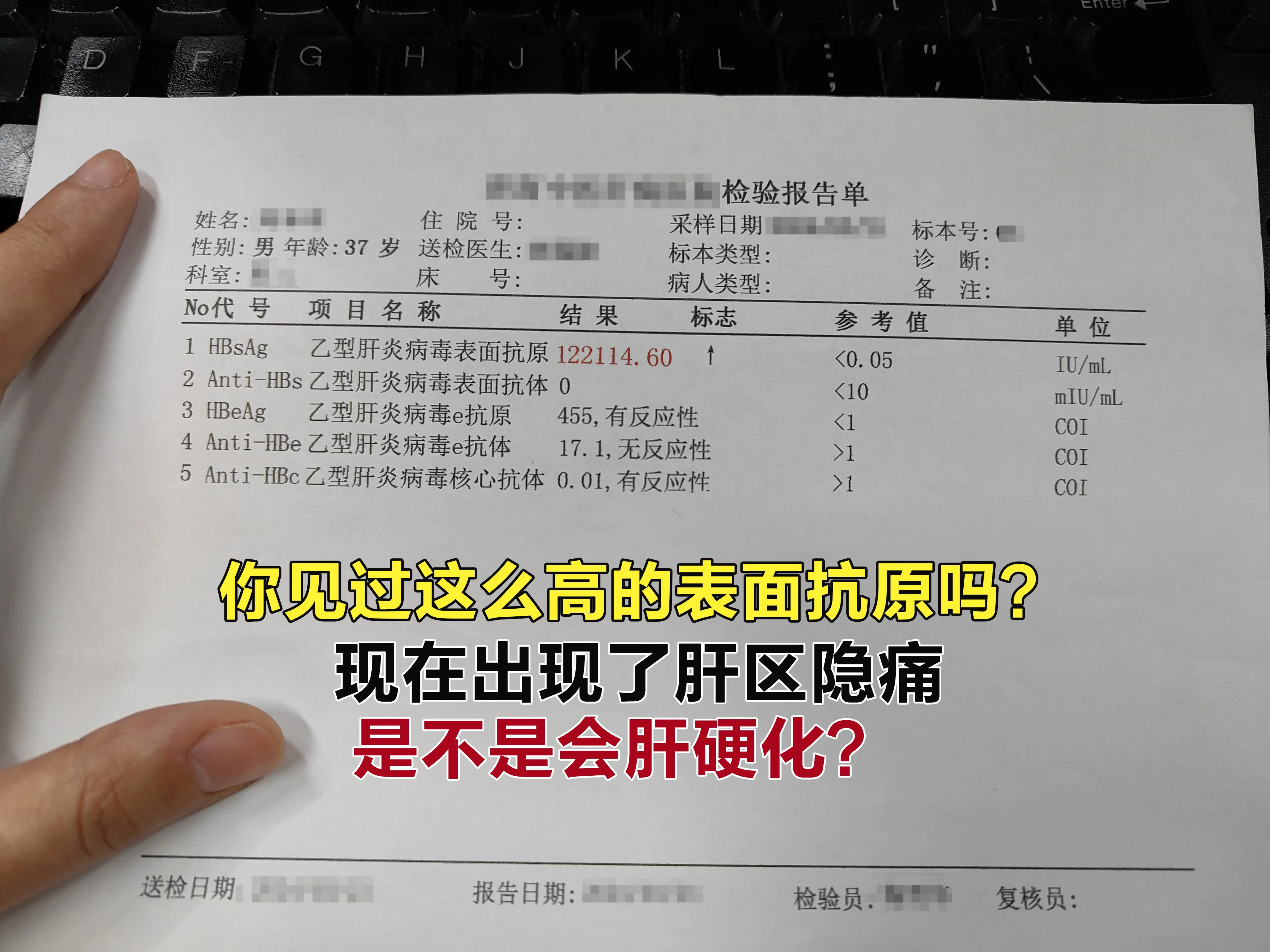 小伙子你这个表面抗原确实比较高，不过也不必过度恐慌，只能说明病毒外壳载...