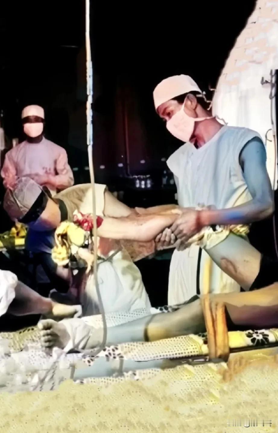 令人心疼的一幕！
老山后方，战地医院的医生，正在急救一名被越军炮弹炸伤右腿的士兵