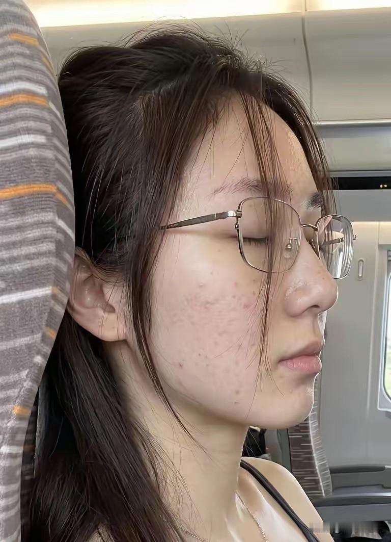 自己本来就长得不怎么好看，现在还长了满脸痘痘，真是烦人又烦心！怎么是好？

虽然
