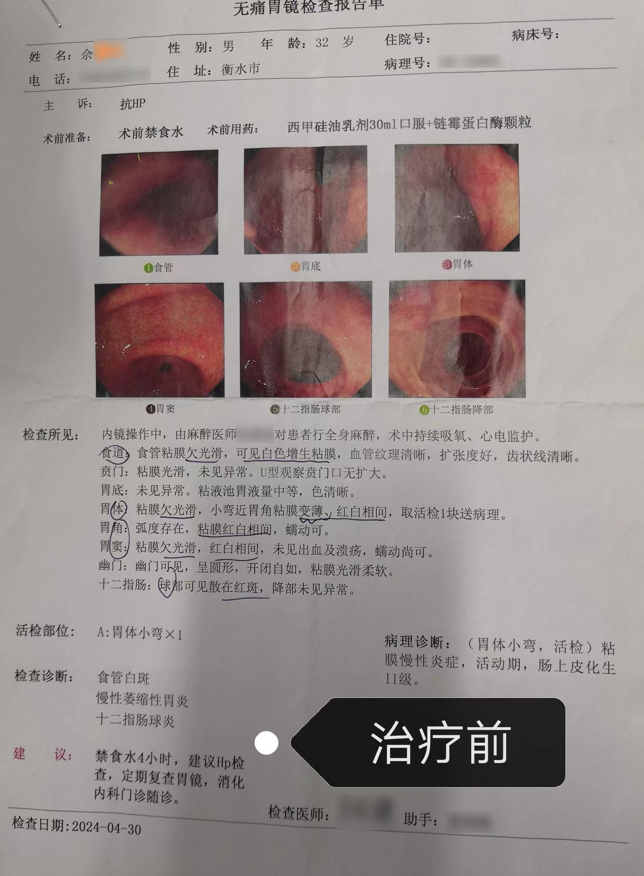 中度肠化生，6个月好了90%！他的坚持值得大家借鉴

胃病不管时间多久，听我真心